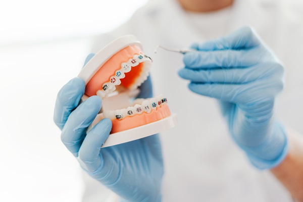 How Often Do Braces Need To Be Tightened?