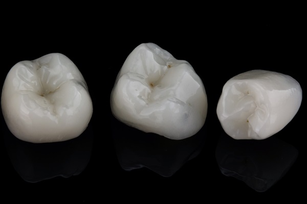 A Same Day Crown Vs  One From A Lab